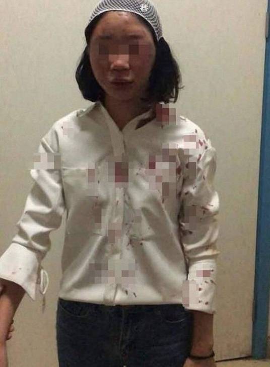 8·17昆明摩的司机打人案