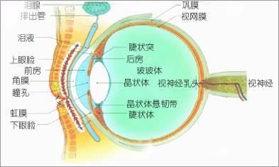 近视眼并发症