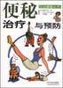 便秘治疗与预防