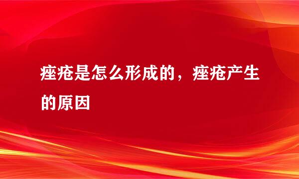 痤疮是怎么形成的，痤疮产生的原因