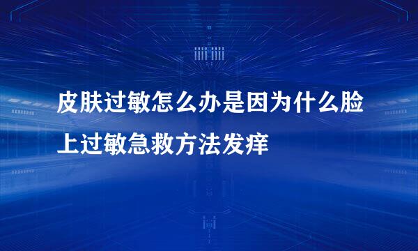 皮肤过敏怎么办是因为什么脸上过敏急救方法发痒