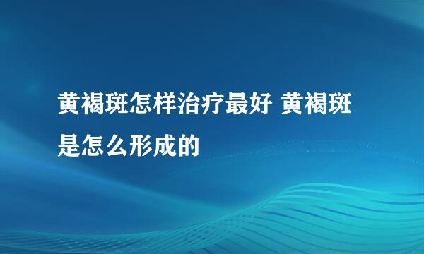 黄褐斑怎样治疗最好 黄褐斑是怎么形成的