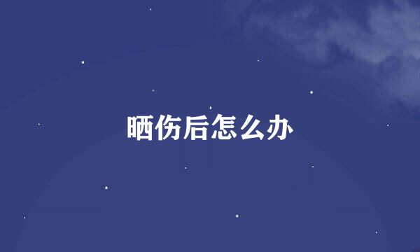 晒伤后怎么办