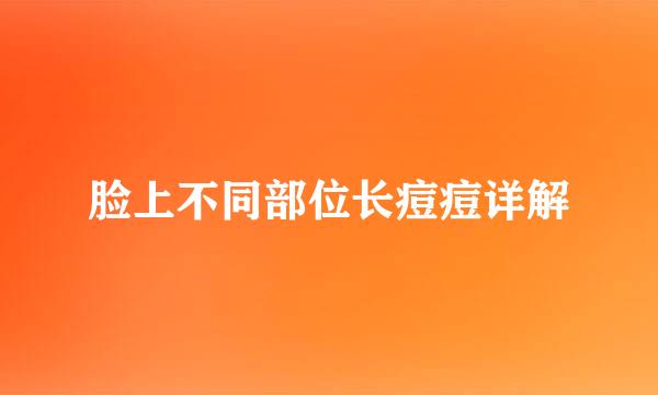 脸上不同部位长痘痘详解