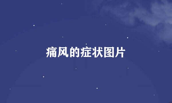 痛风的症状图片