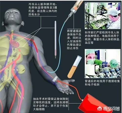 首例冷冻人复活