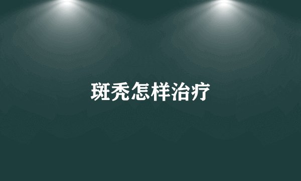 斑秃怎样治疗
