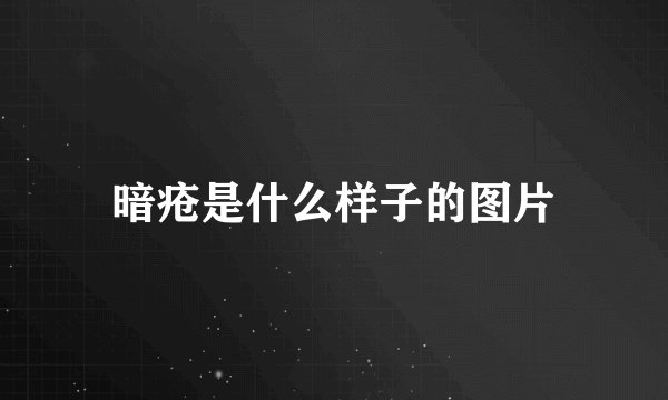 暗疮是什么样子的图片