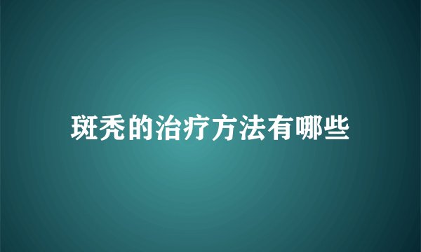 斑秃的治疗方法有哪些