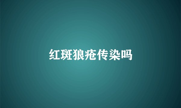 红斑狼疮传染吗