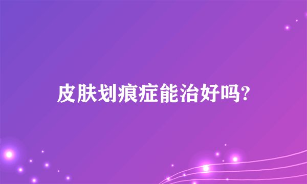 皮肤划痕症能治好吗?