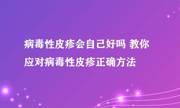 病毒性皮疹会自己好吗 教你应对病毒性皮疹正确方法