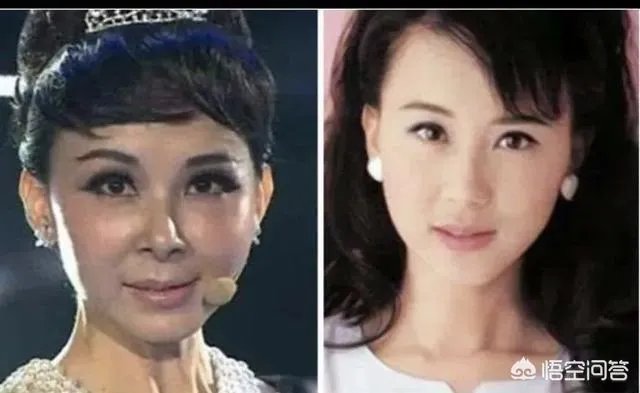 有哪些整容失败的明星?