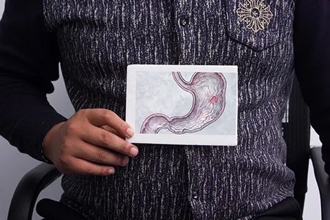 胃穿孔严重吗