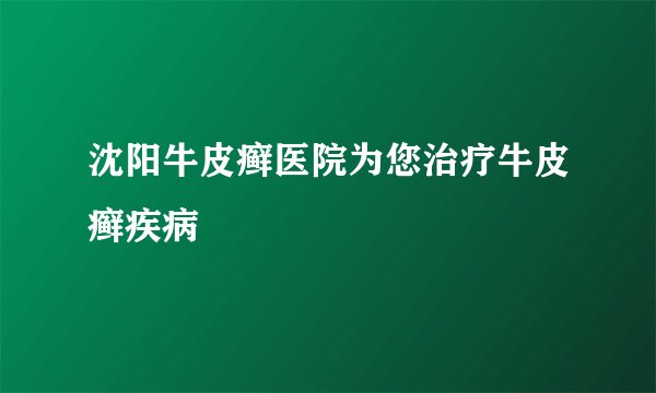 沈阳牛皮癣医院为您治疗牛皮癣疾病