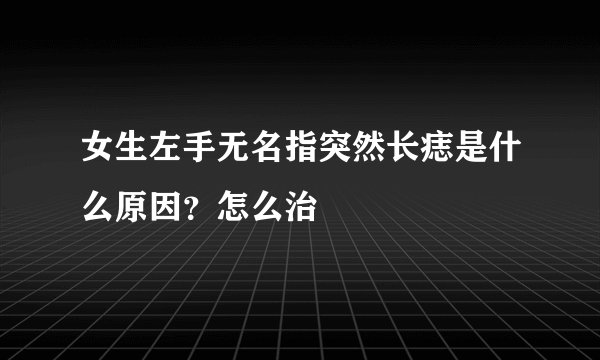 女生左手无名指突然长痣是什么原因？怎么治