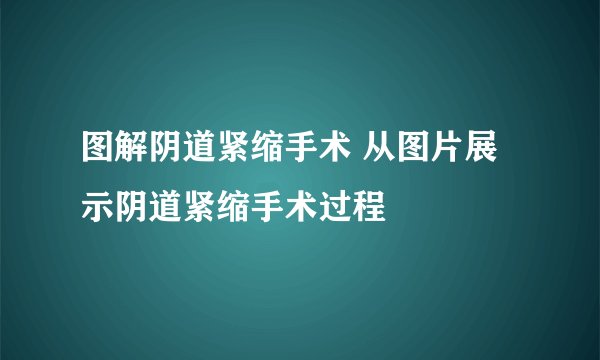 图解阴道紧缩手术 从图片展示阴道紧缩手术过程