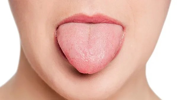 舌头烫伤怎么办