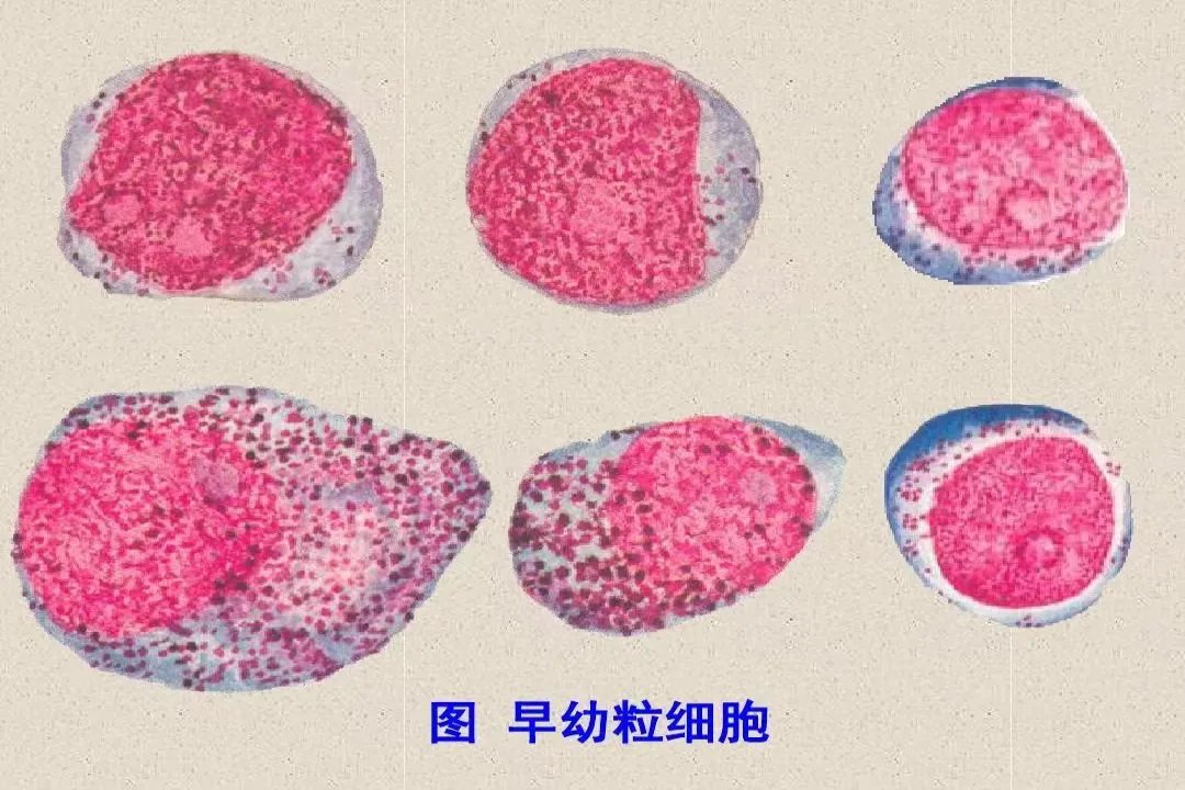 早幼粒细胞图片