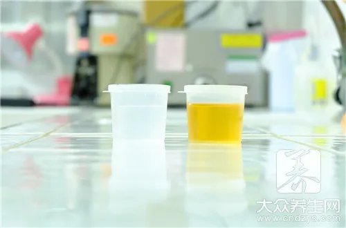 结晶尿有什么危害