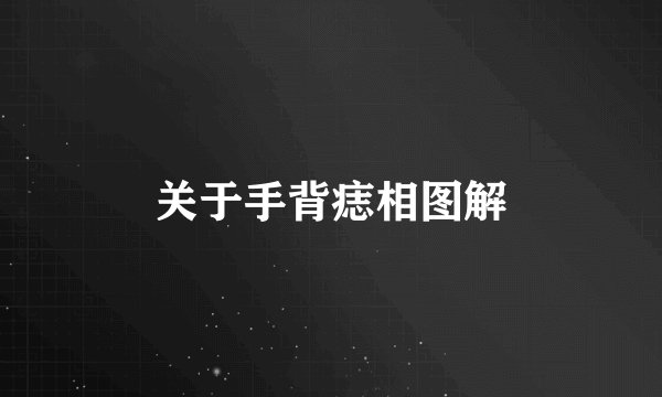 关于手背痣相图解