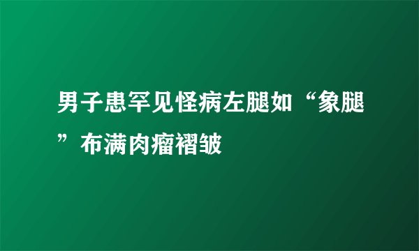 男子患罕见怪病左腿如“象腿”布满肉瘤褶皱