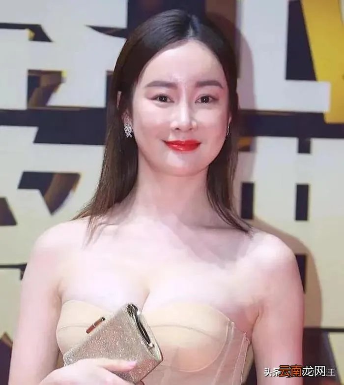 张檬承认自己后悔整容 张檬整容前后照片对比