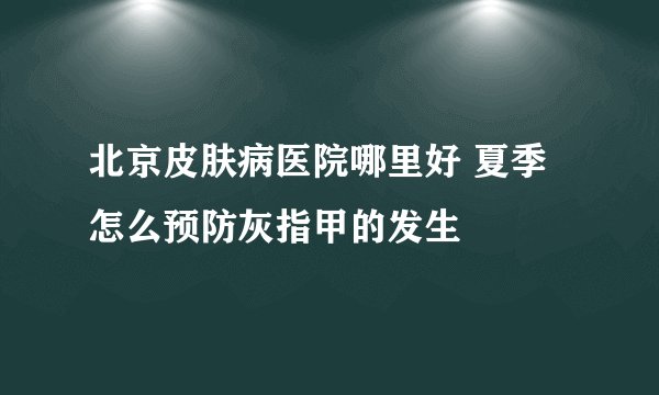 北京皮肤病医院哪里好 夏季怎么预防灰指甲的发生