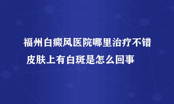 福州白癜风医院哪里治疗不错 皮肤上有白斑是怎么回事