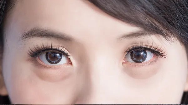 怎么消除眼袋