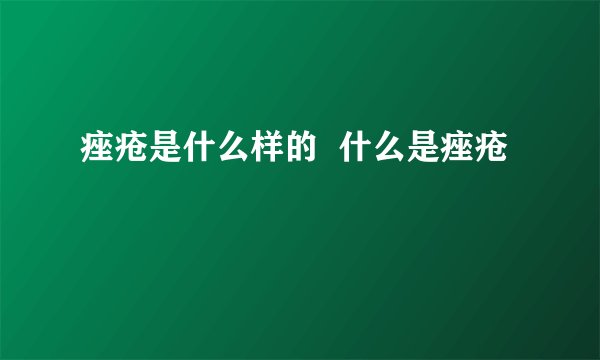 痤疮是什么样的 什么是痤疮