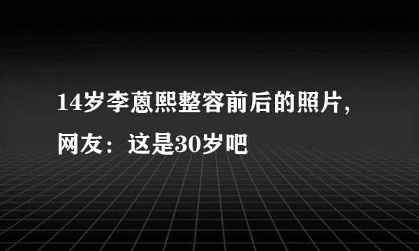 14岁李蒽熙整容前后的照片,网友：这是30岁吧