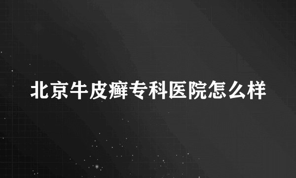 北京牛皮癣专科医院怎么样