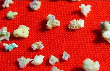 什么是舍利子
