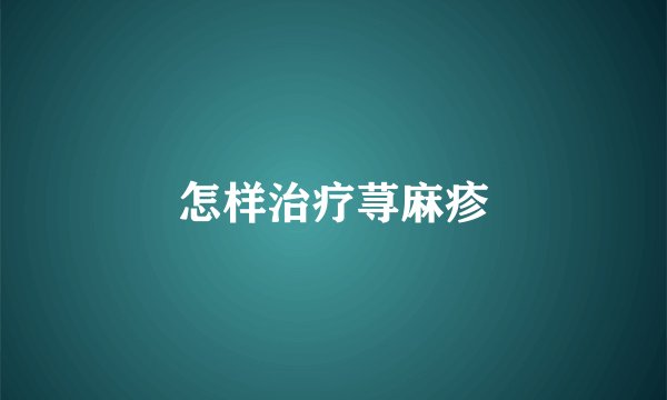 怎样治疗荨麻疹