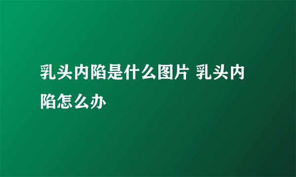乳头内陷是什么图片 乳头内陷怎么办