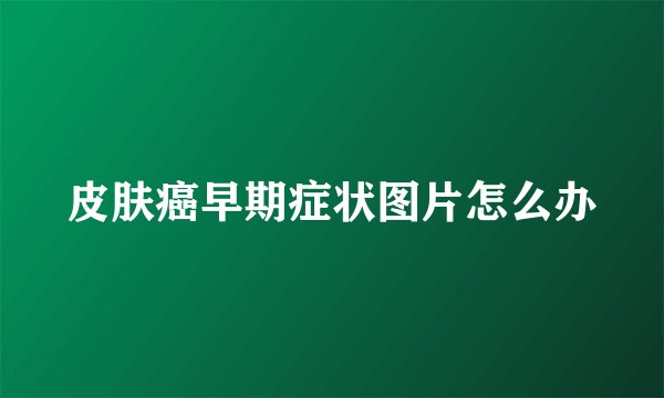 皮肤癌早期症状图片怎么办
