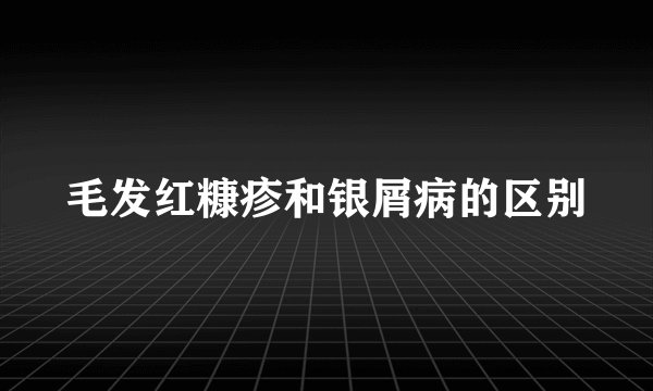 毛发红糠疹和银屑病的区别