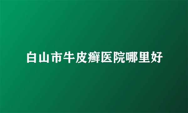 白山市牛皮癣医院哪里好