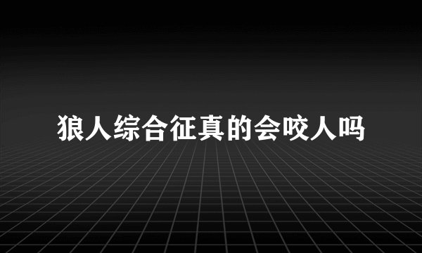 狼人综合征真的会咬人吗