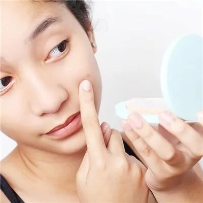 怎么可以快速去除青春痘