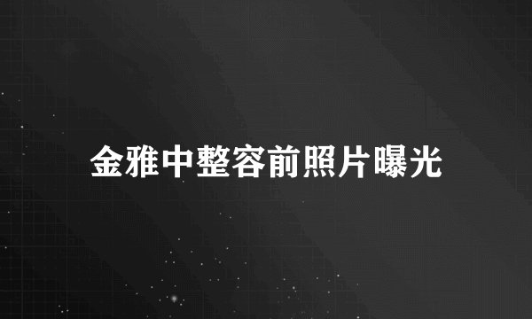 金雅中整容前照片曝光