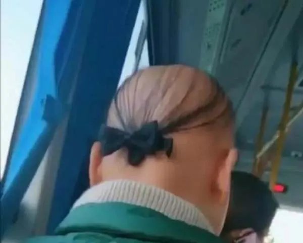 20岁小伙健身半年变秃,竟然和“坚持健身”有关系