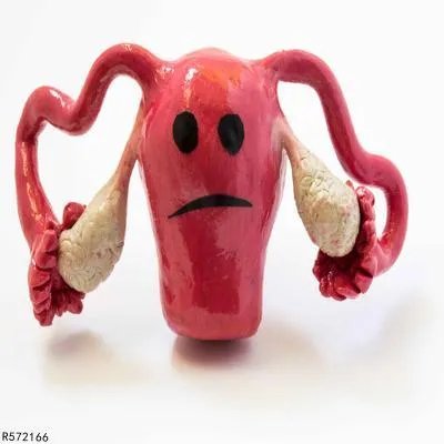 宫颈糜烂是怎么回事  诱发宫颈糜烂的5个原因