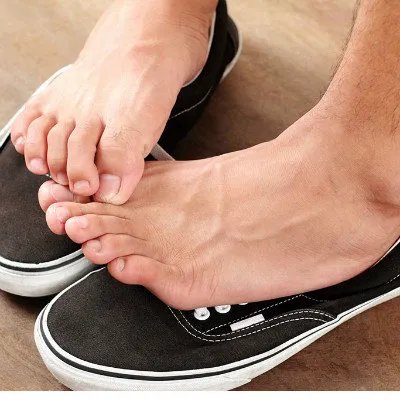 突然有了水疱型脚气？