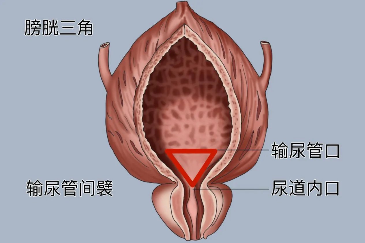 尿道口是什么样