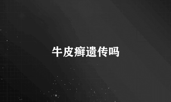 牛皮癣遗传吗