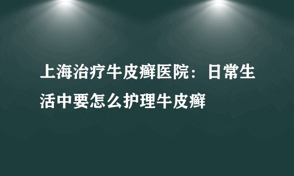 上海治疗牛皮癣医院：日常生活中要怎么护理牛皮癣