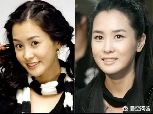 有哪些整容失败的明星?