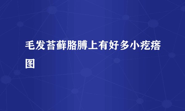 毛发苔藓胳膊上有好多小疙瘩图